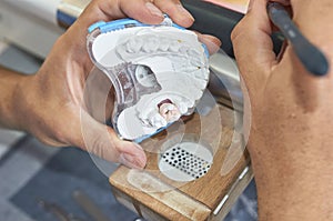 Dental technician using a brush with ceramic dental implants in