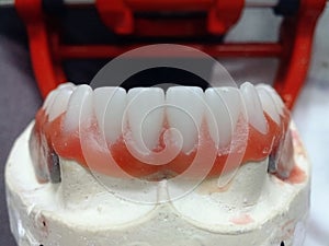 Dental technician at work photo