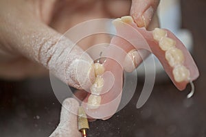 Dental technician work on denture prothesis in dental laboratory