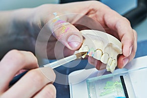Dental technician work. prosthesis production. teeth prototype construction