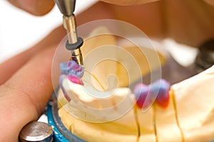 Dental technician working