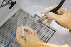 Dental Technician Working On 3D Printed Mold For Tooth Implants