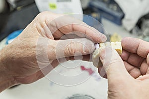 Dental Technician Working On 3D Printed Mold For Tooth Implants