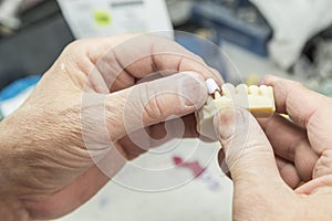 Dental Technician Working On 3D Printed Mold For Tooth Implants