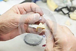 Dental Technician Working On 3D Printed Mold For Tooth Implants