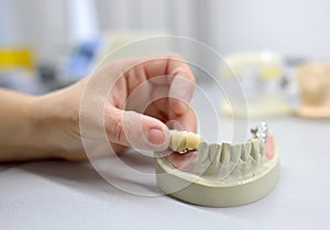 Dental technician working photo