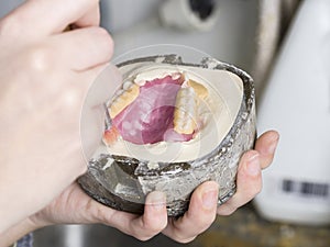 Dental technician is working with a dental flask of a complete u