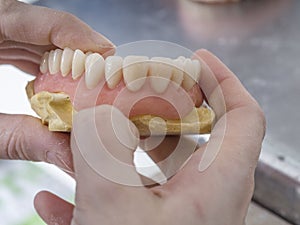 Dental technician is working with porcelain teeth in a cast mold photo