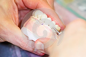 Dental technician working on a tooth crown