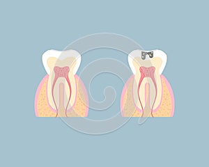 Dental teeth care, internal organs, tooth anatomy, nervous system, periodontal