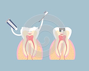 dental teeth care with tooth decay, cavity, caries, internal organs anatomy nervous system, periodontal