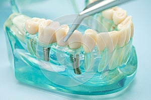 Dental teeth model with dentist tool for dentistry