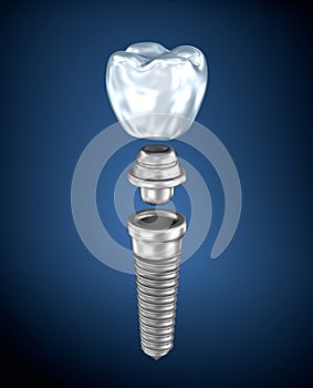 Dental titanium implant photo