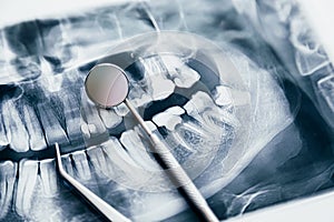 Dental toold and jaw x-ray. Dental treatment concept