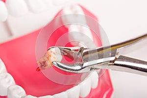 Dental tools and remove tooth at clinic isolated