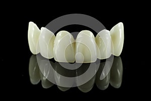 Dental Tooth Bridge