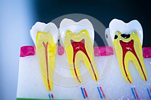 Dental tooth model
