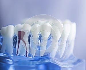 Zubní zub kořen 
