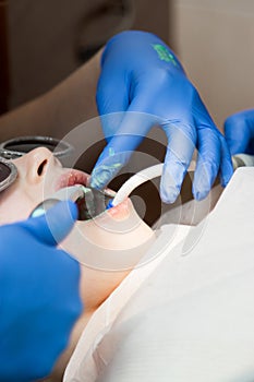 Dental treatment close-up female patient mouth with medical tools. Dentist doing treatment and dental care.