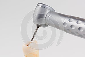 Dental turbine handpiece