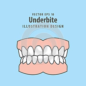 Dental underbite teeth illustration vector design on blue background. Dental care concept