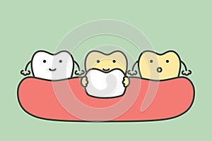 Dental veneers installation procedure for tooth whiten