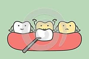 Dental veneers installation procedure for tooth whiten photo