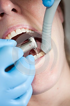 Dental water drill