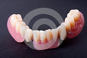 Dental wax model