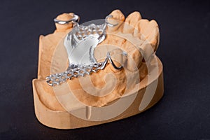 Dental wax model