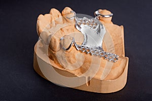 Dental wax model