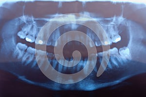 Dental x-ray