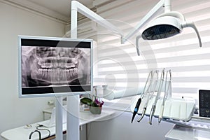 Dental x-ray footage in dental clinic photo