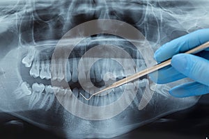 Dental X-ray. Radiography