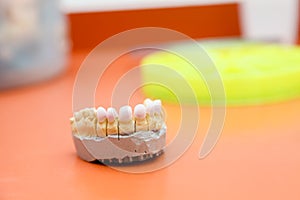 Zircon teeth photo