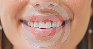 Dental, zoom and woman smile with teeth whitening, results or oral hygiene treatment. Mouth, closeup and female person