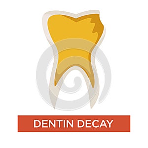 Dentin decay isolated dental care and medicine dentistry photo