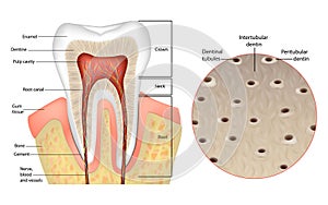 Dentin or dentine Structure. Intertubular dentin, Peritubular dentin, Dentinal tubules.