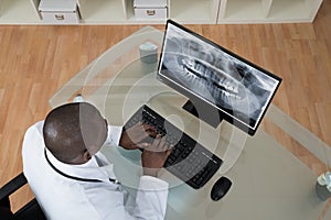 Dentist Analyzing X-ray Teeth On Computer