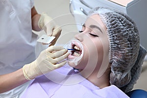 The dentist applies the gel to the patient`s teeth before professional dental cleaning. Prevention of caries and gum
