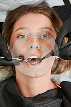 Dentist in black sterile gloves examining woman teeth.