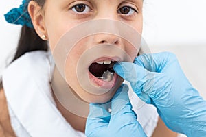 Dentist is check and set dimension of brackets. Talking to girl about braces in her mouth