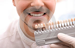 Dentist checking young man`s teeth color