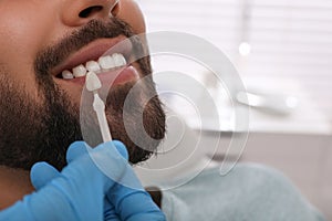 Dentist checking young man`s teeth color in clinic, closeup