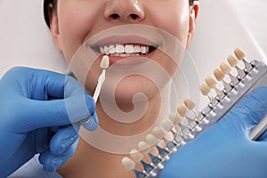 Dentist checking young woman`s teeth color in clinic, closeup