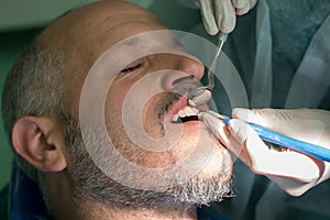 Dentist checks a man's teeth for general oral hygene