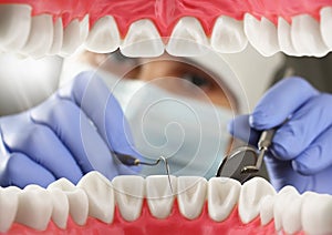 Dentist checkup patient teeth, Inside mouth view