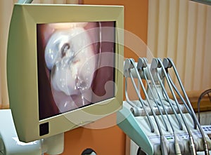 At the dentist - close up