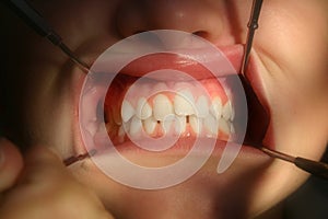 Dentist in close-up inspection