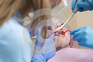 Dentist curing a woman patient in the dental office in a pleasant environment. Close-up portrait of a female patient